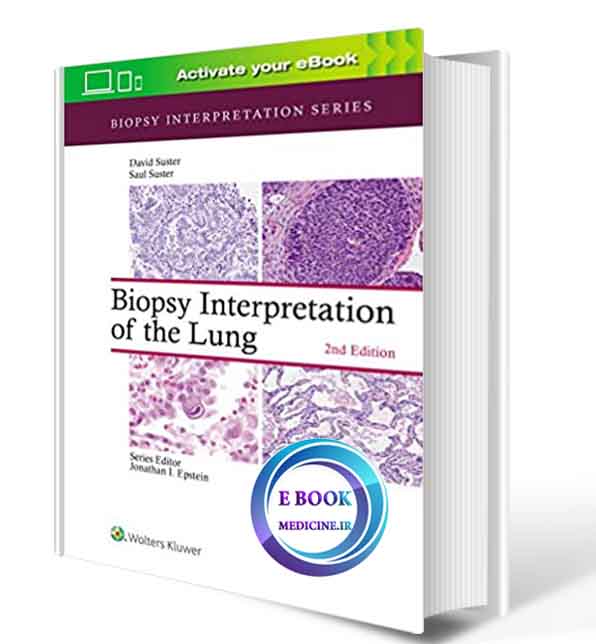 دانلود کتابBiopsy Interpretation of the Lung 2nd2020 ( PDF)